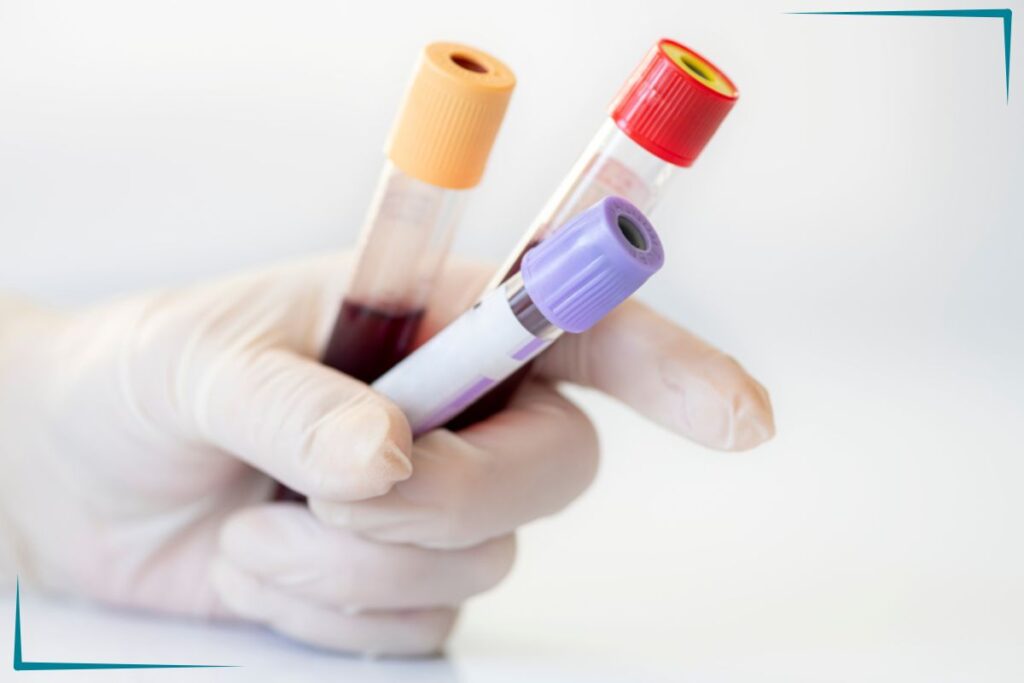 Someone holding 3 vials of blood.